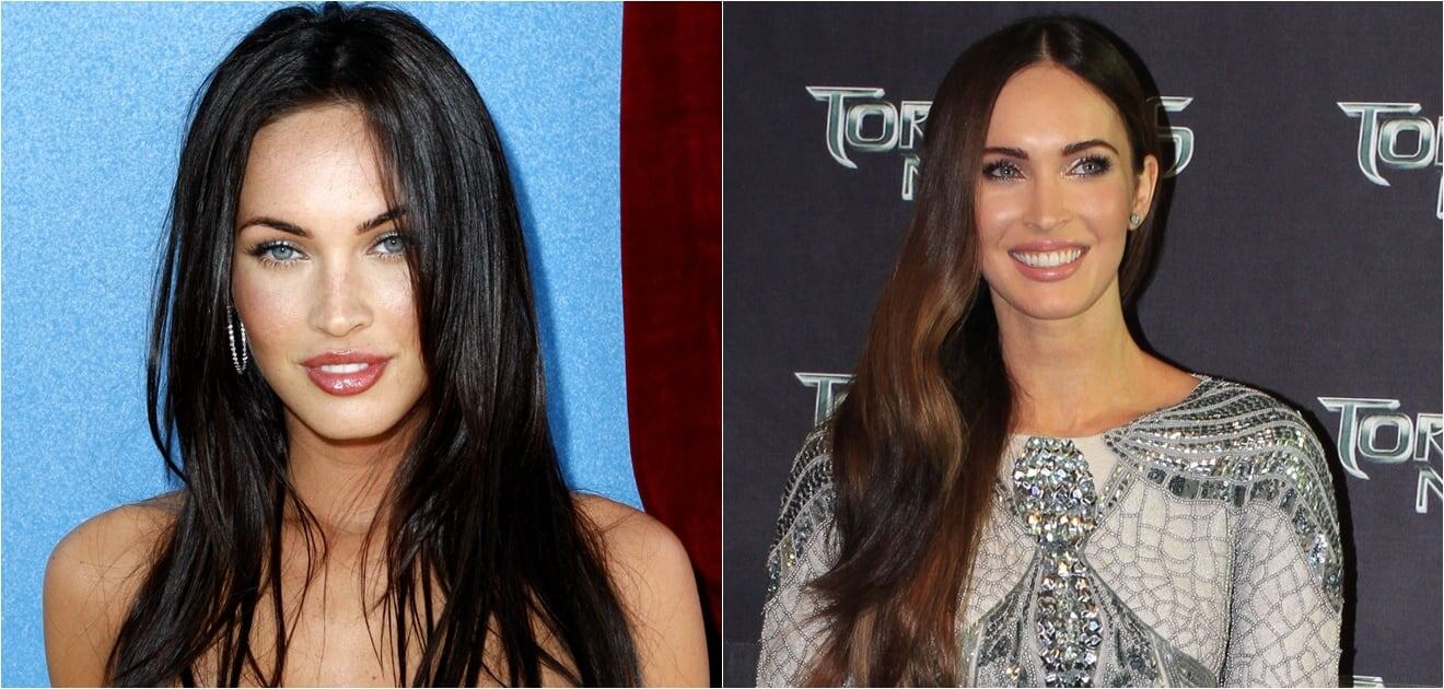 Famosos que cambiaron por completo sus rostros con cirugías o bótox