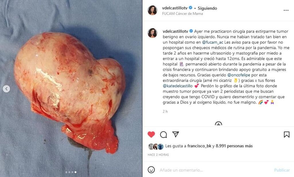 Verónica del Castillo revela que le extirparon un tumor en un ovario