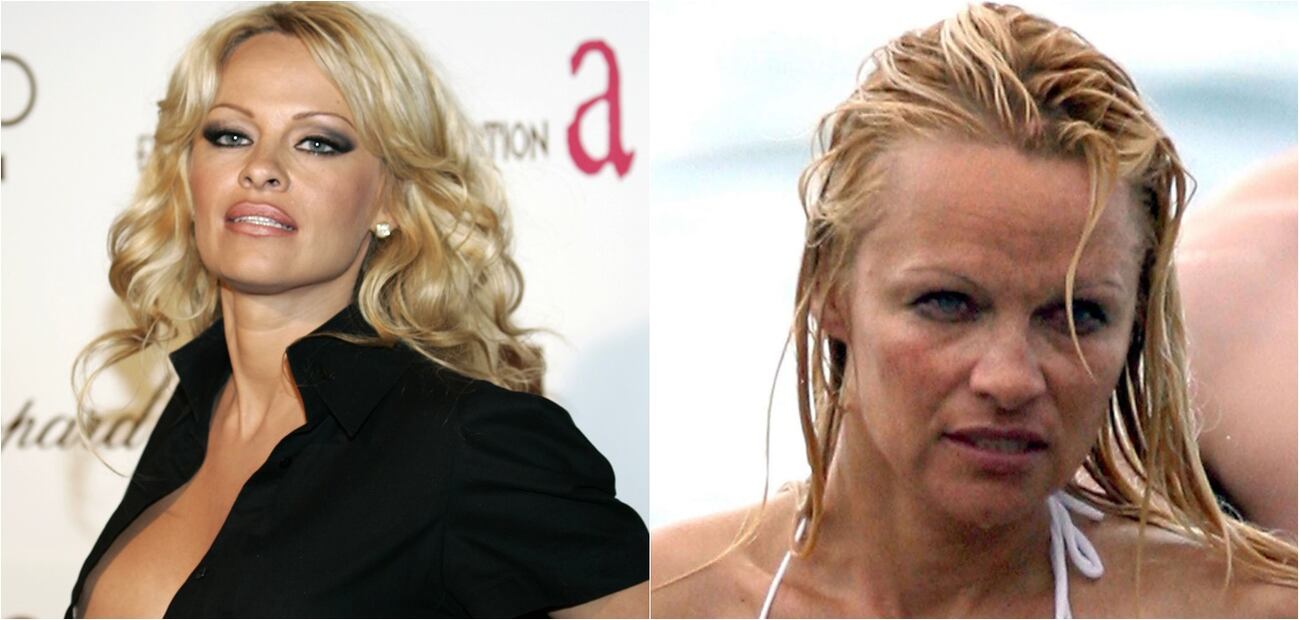 Las peores fotos de las celebridades