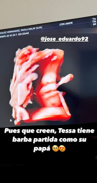 Tessa, la bebé de José Eduardo Derbez y Paola Dalay
Foto: Instagram @paodalay_2203