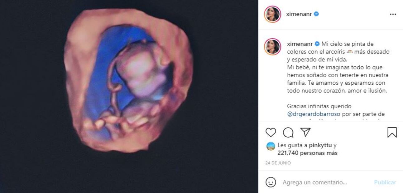 Ximena Navarrete y Juan Carlos Valladares revelan el sexo de su bebé