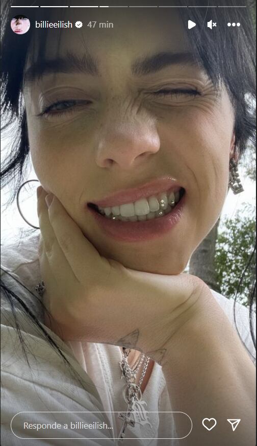 Billie Eilish presume su sonrisa con joyas / Instagram
