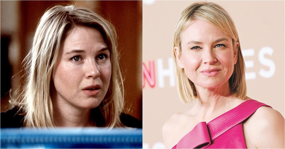 Famosos víctimas del botox 