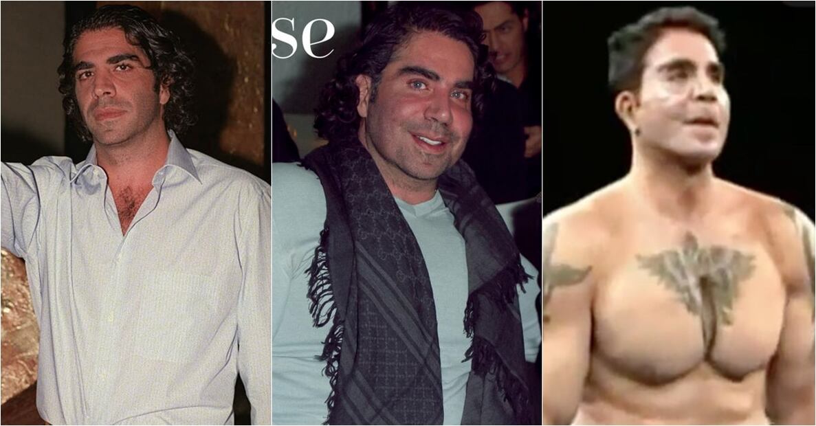 Famosos que deformaron sus rostros con cirugías plásticas