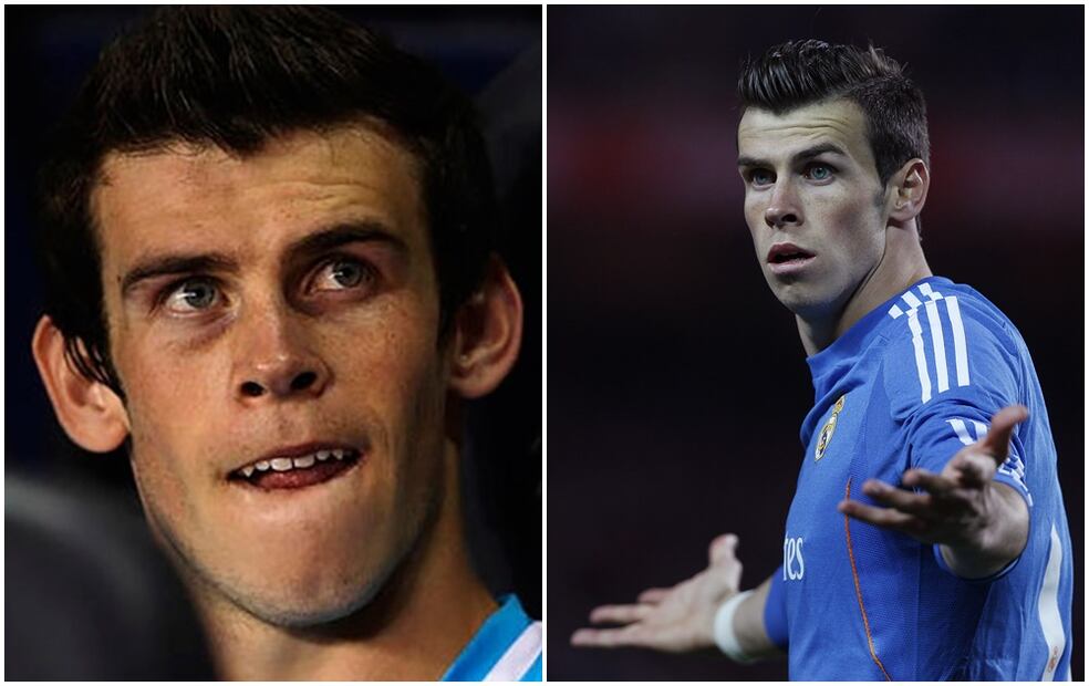 FOTOS: Antes y después de futbolistas que se operaron el rostro