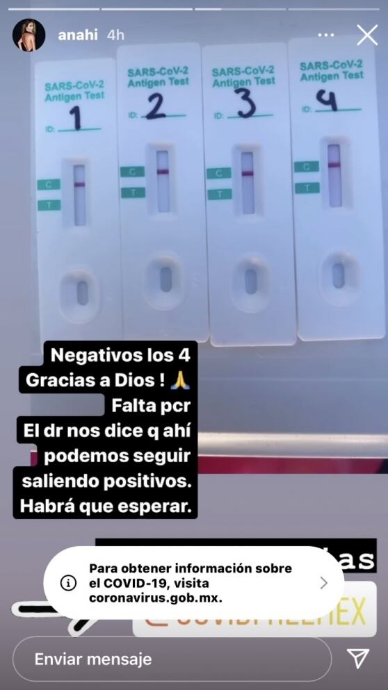 Anahí confirmó que sí se contagió de Covid-19 en el concierto de RBD