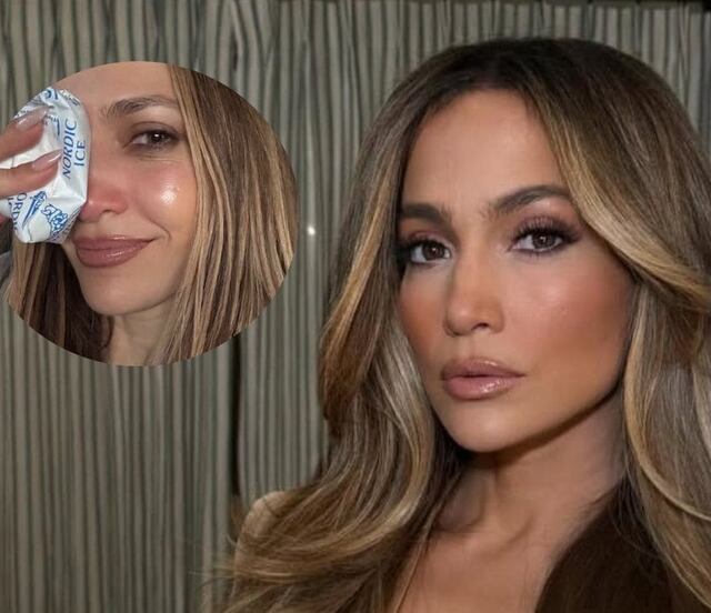 Fotos: Jennifer Lopez sufre doloroso accidente previo a los American Music Awards