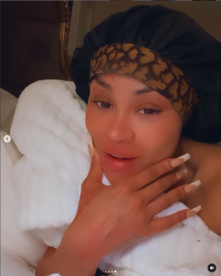 Blac Chyna muestra su nueva cara en un antes y después tras retirarse los fillers