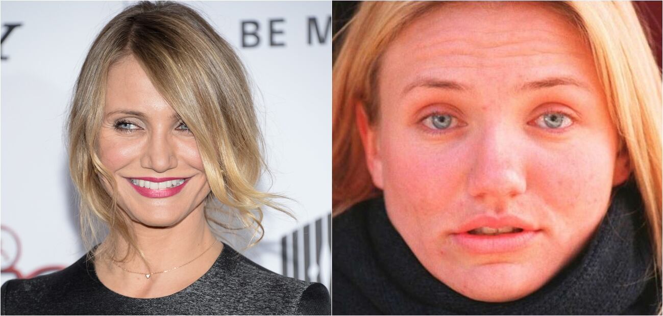 Las peores fotos de las celebridades