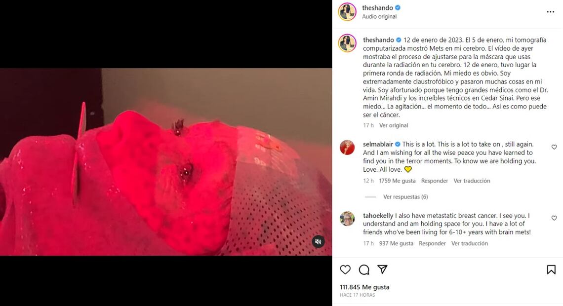 La actriz Shannen Doherty comparte un video sobre su tratamiento contra la metástasis en su cerebro