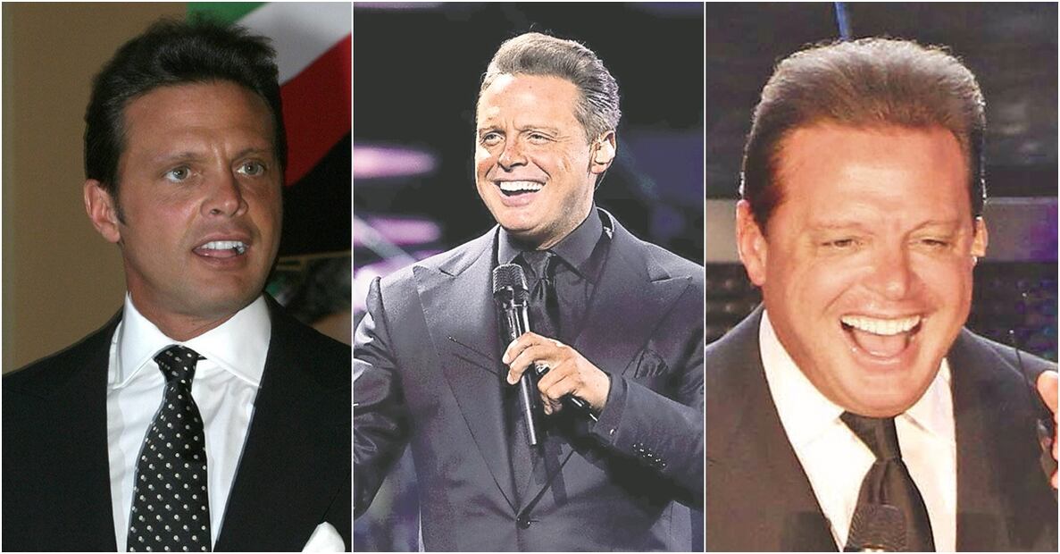 ¿Cómo se transformó el rostro de Luis Miguel?