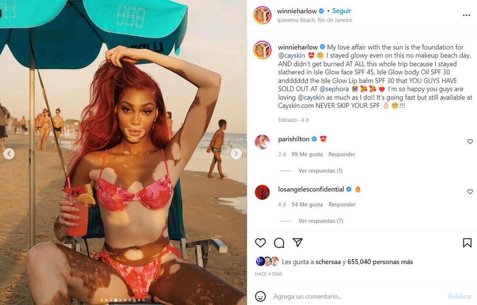 Winnie Harlow luce su increíble figura con mini bikini en la playa de Brasil