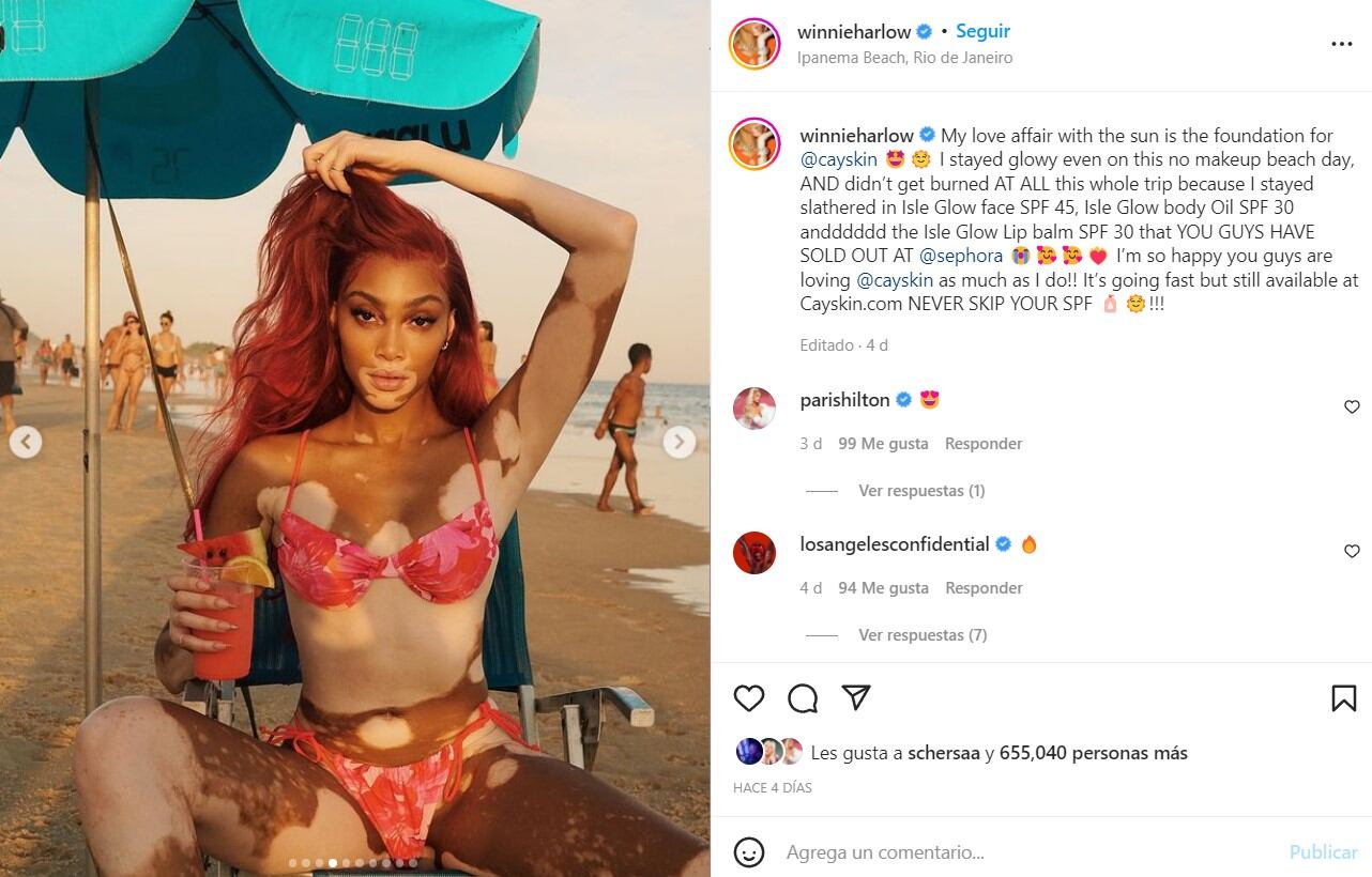 Winnie Harlow luce su increíble figura con mini bikini en la playa de Brasil