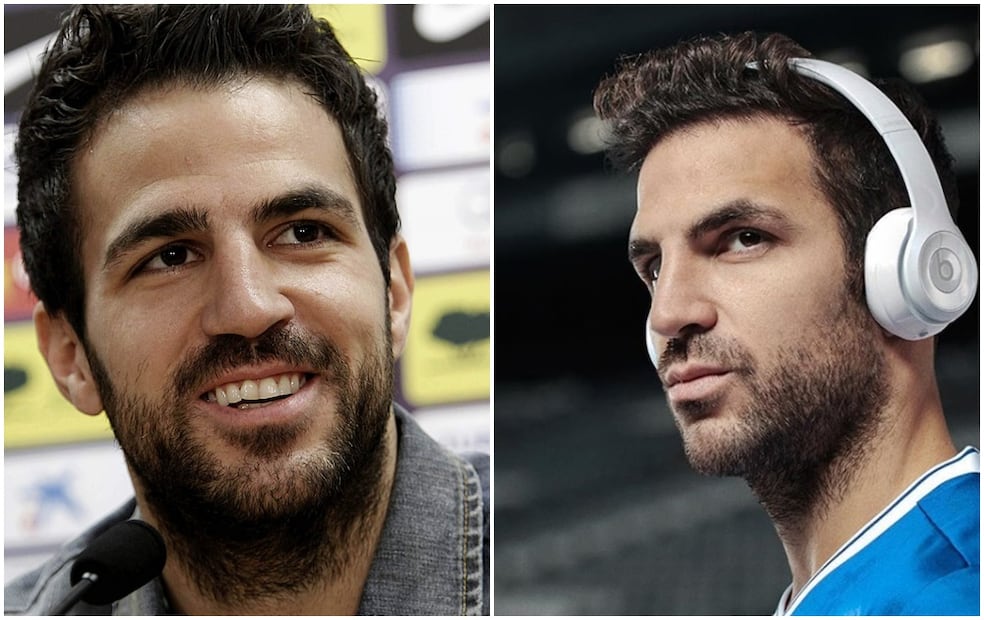 FOTOS: Antes y después de futbolistas que se operaron el rostro