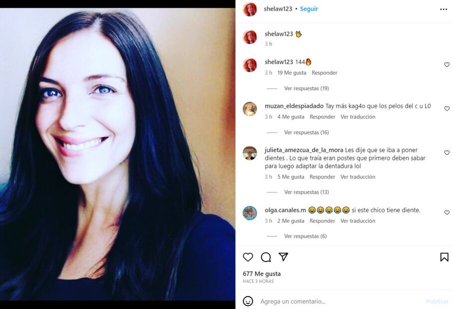 Así luce la nueva sonrisa de Camilo Blanes / Instagram