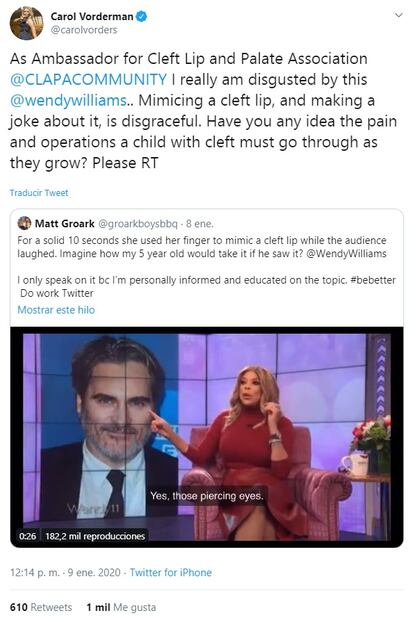 La presentadora de televisión Wendy Williams se burló de la cicatriz en el labio de Joaquin Phoenix 