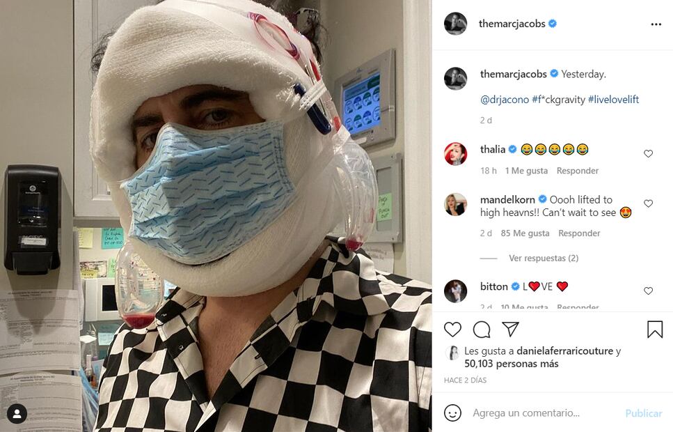 Marc Jacobs luce impactante tras levantamiento facial: comparte foto en cápsula de oxígeno