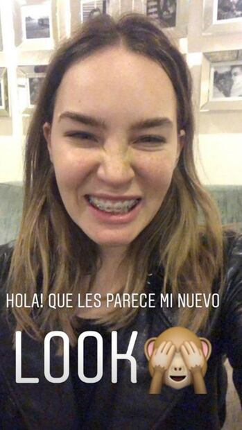 Belinda estrena nuevo look ¡con brackets!