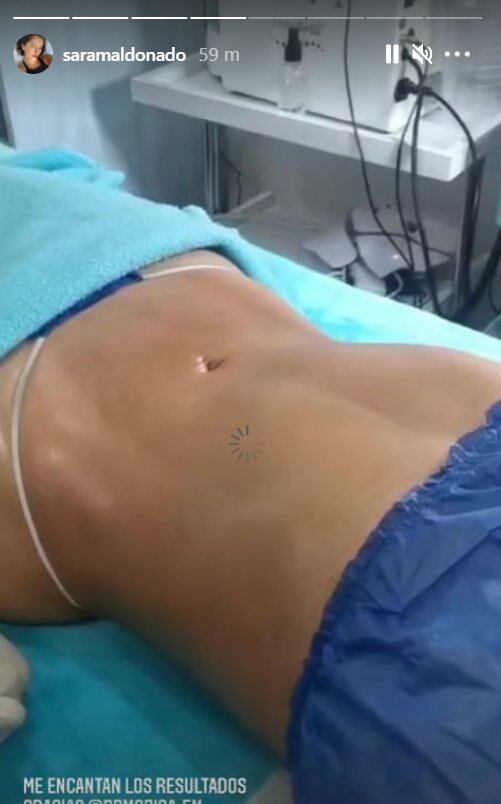 ¡Sara Maldonado lo vuelve a hacer y presume cinturita a un mes de la lipo!