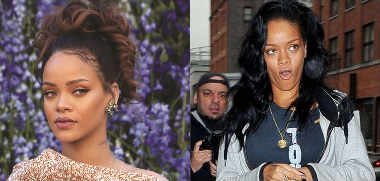 Las peores fotos de las celebridades