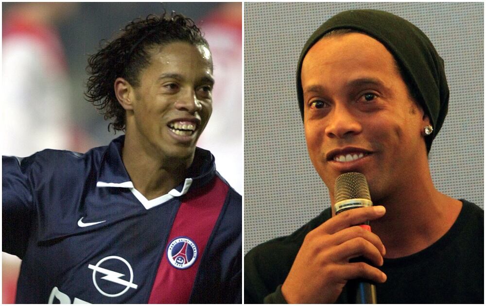 FOTOS: Antes y después de futbolistas que se operaron el rostro