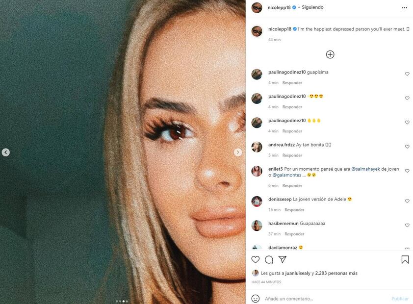 ¿Qué se hizo Nicole Peña en la cara? Su impactante transformación ¡luce guapísima!
