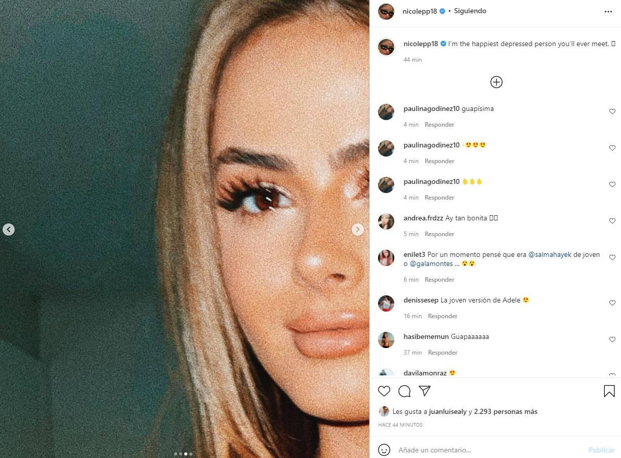 ¿Qué se hizo Nicole Peña en la cara? Su impactante transformación ¡luce guapísima!