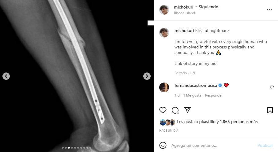 Micho Kuri: “La decisión más estúpida de mi vida”, sobre su accidente