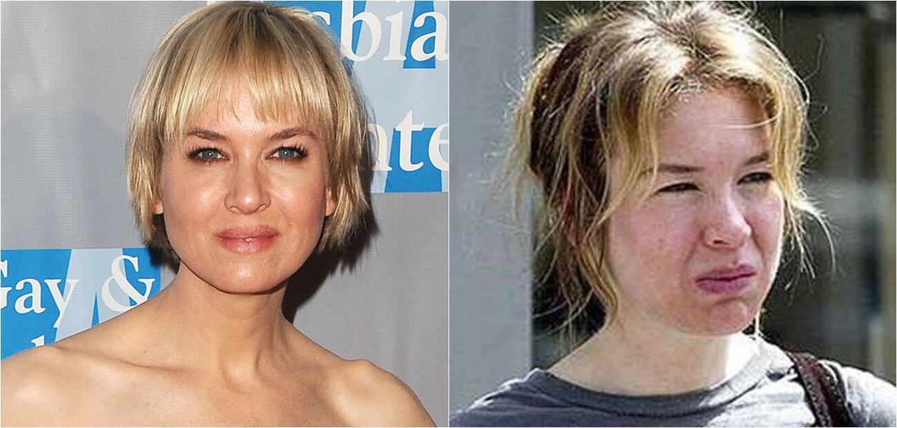 Las peores fotos de las celebridades