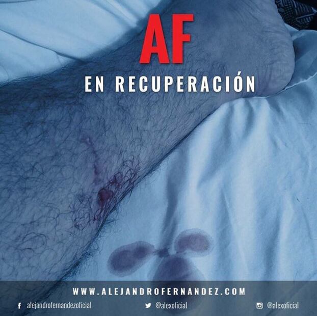 Alejandro Fernández en público después de estar al borde la muerte
