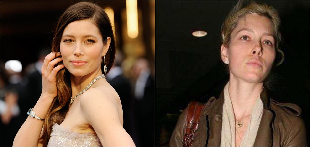 Las peores fotos de las celebridades