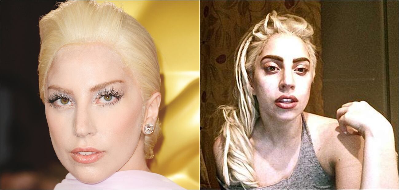 Las peores fotos de las celebridades