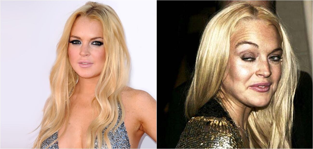 Las peores fotos de las celebridades