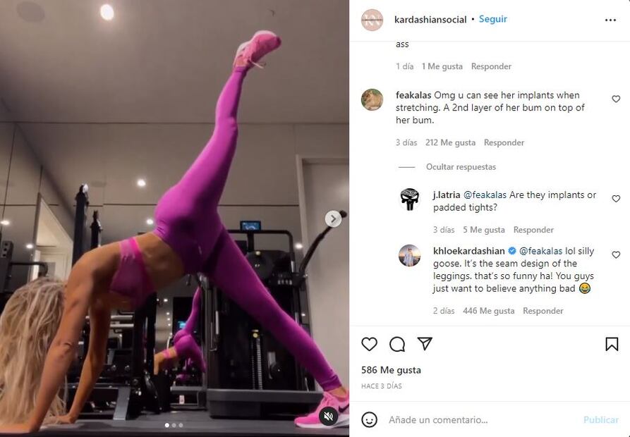 ¿Khloé Kardashian tiene implantes? Esta es la verdad