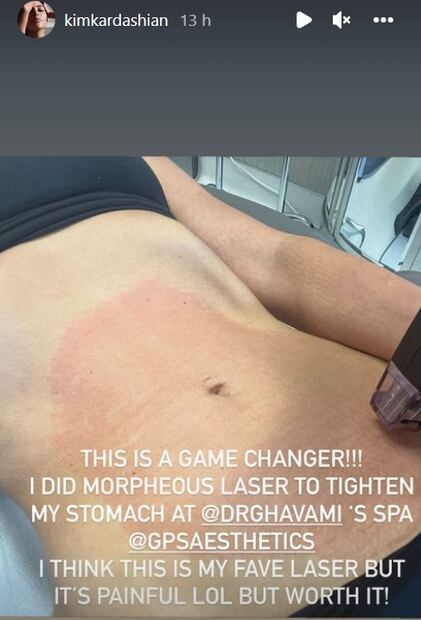 Kim Kardashian comparte doloroso método para reducir abdomen