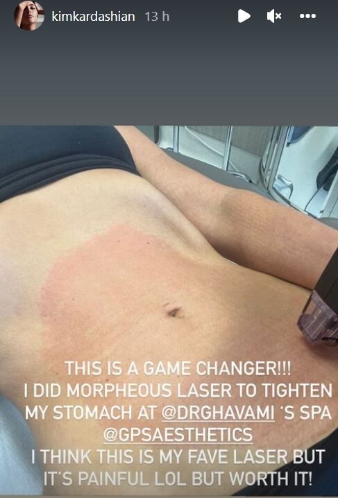 Kim Kardashian comparte doloroso método para reducir abdomen