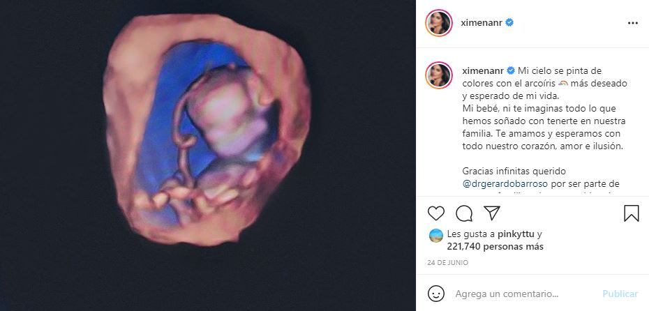 Ximena Navarrete habla de la pérdida de su primer bebé