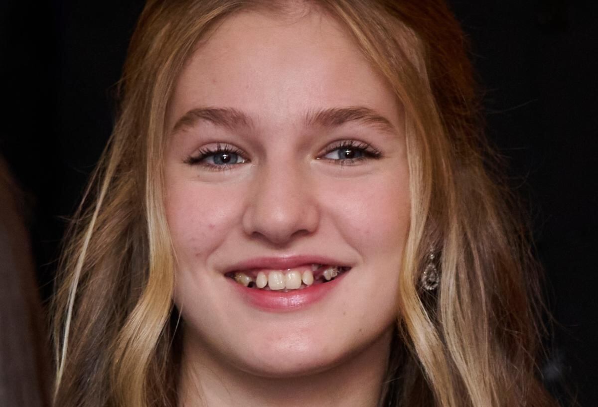 El tratamiento dental de la princesa Leonor de España