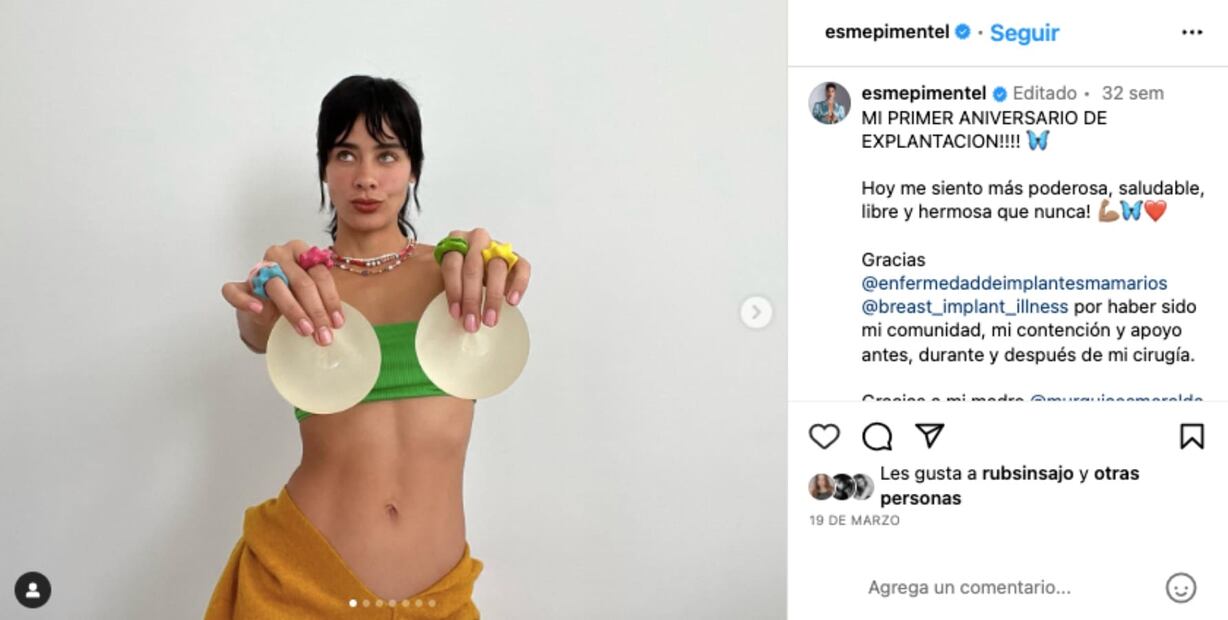 Instagram: @esmepimentel