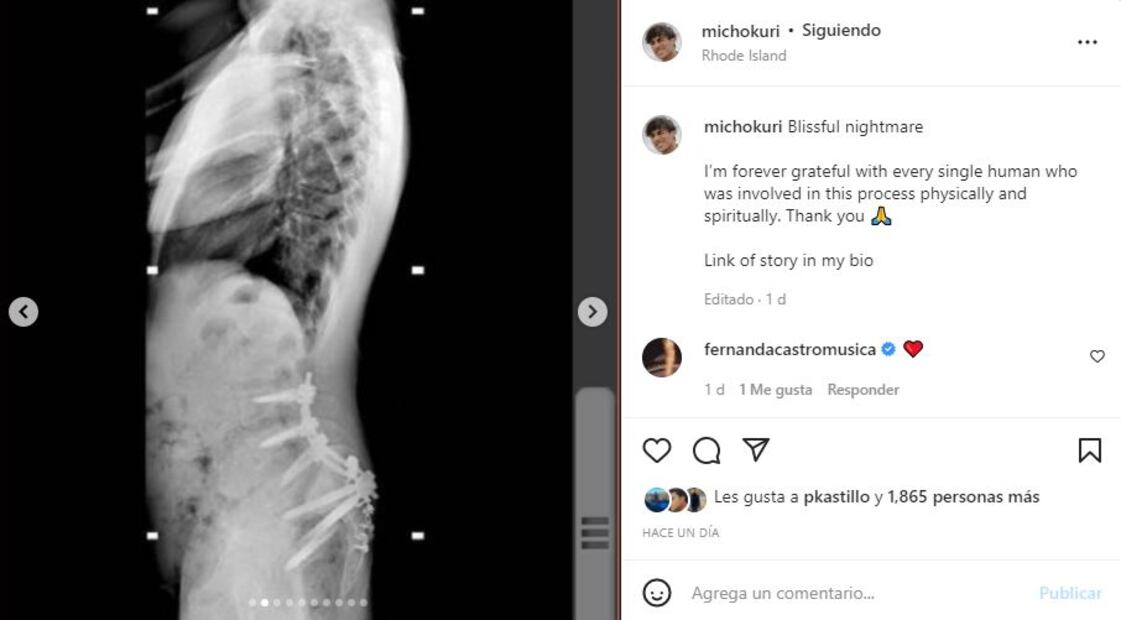 Micho Kuri: “La decisión más estúpida de mi vida”, sobre su accidente