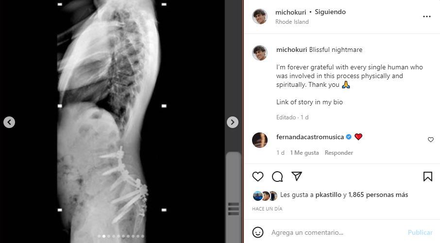 Micho Kuri: “La decisión más estúpida de mi vida”, sobre su accidente