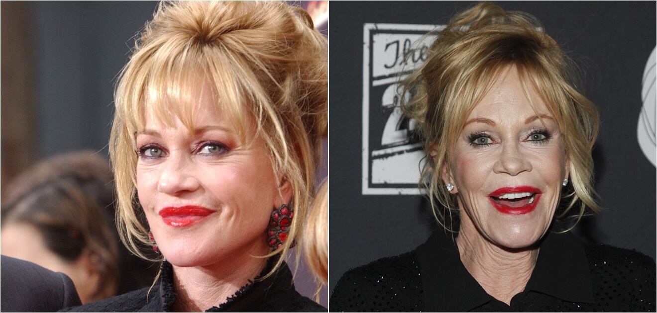 Famosos que cambiaron por completo sus rostros con cirugías o bótox