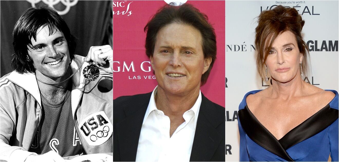 Famosos que envejecieron mal