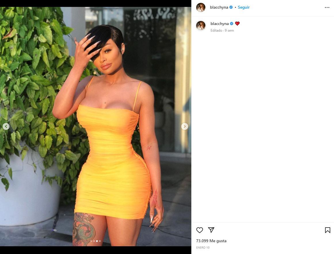 Blac Chyna, ex de Rob Kardashian, se transforma y se retira rellenos faciales