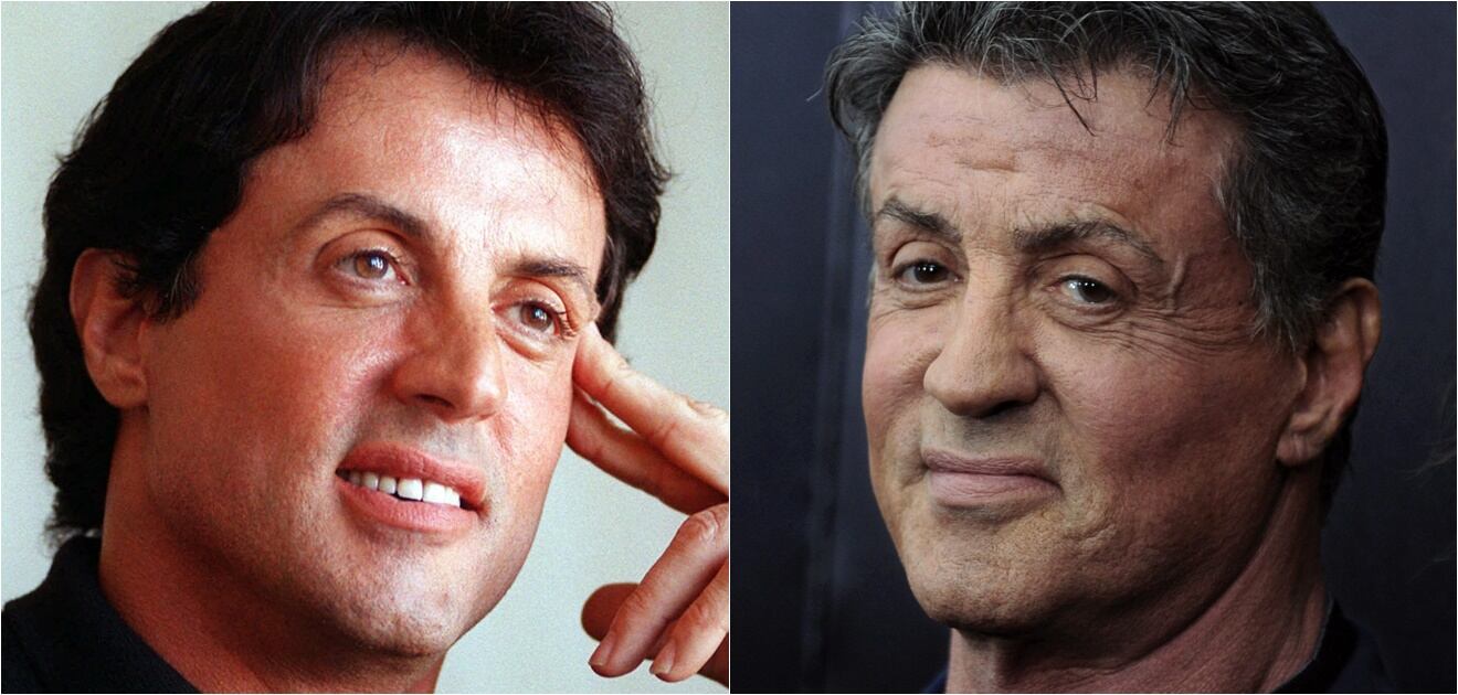 Famosos que envejecieron mal