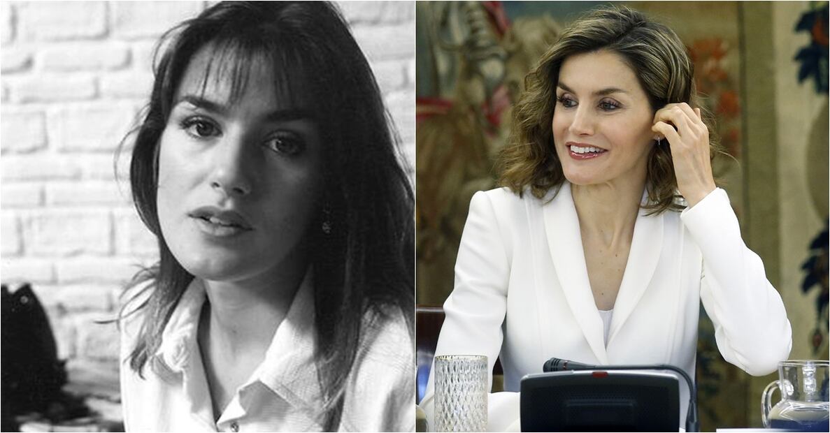 Las integrantes de la realeza que se han hecho cirugías estéticas 