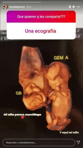 Claudia Álvarez muestra su tierno embarazo de gemelos