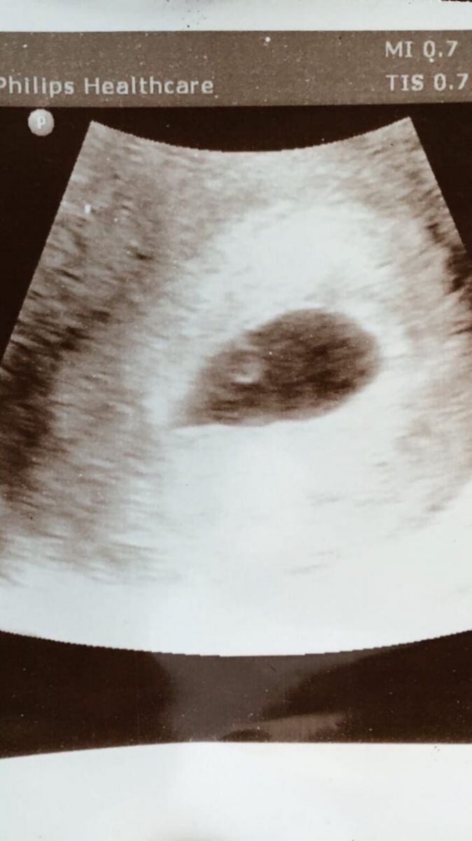 Ya nació el primer bebé de Karla Souza