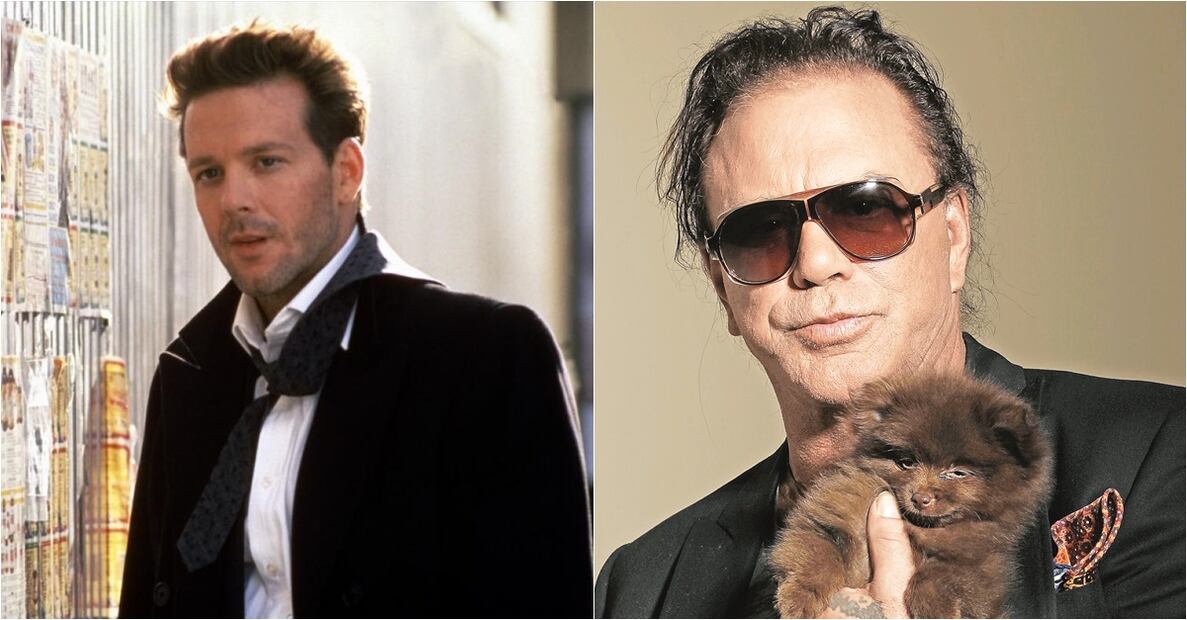 Famosos víctimas del botox 