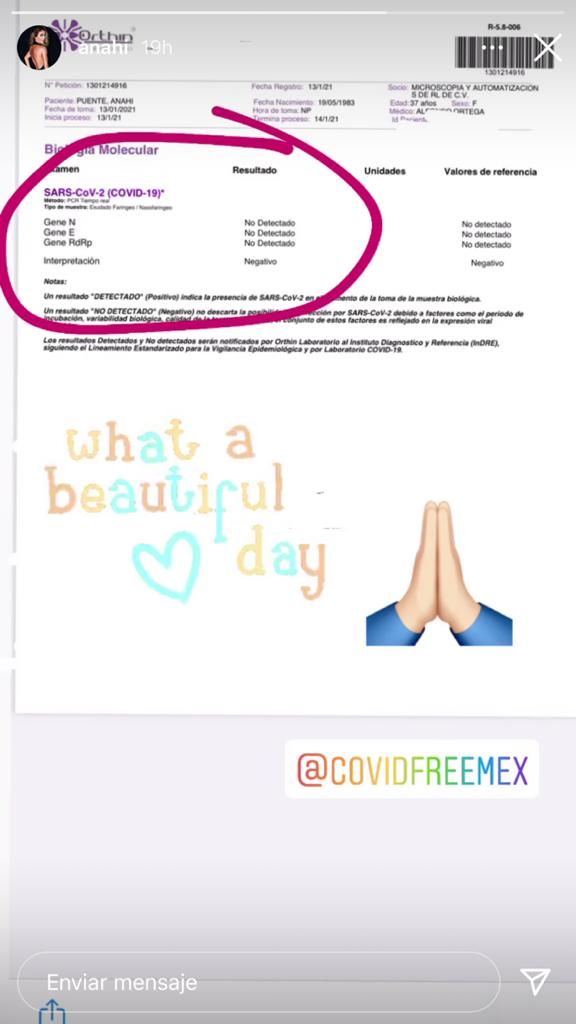 Anahí confirmó que sí se contagió de Covid-19 en el concierto de RBD